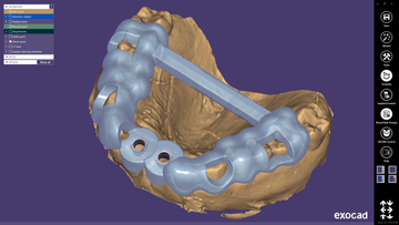exoplan with Guide Creator + 4 exoplan licenses (Initial Purchase)